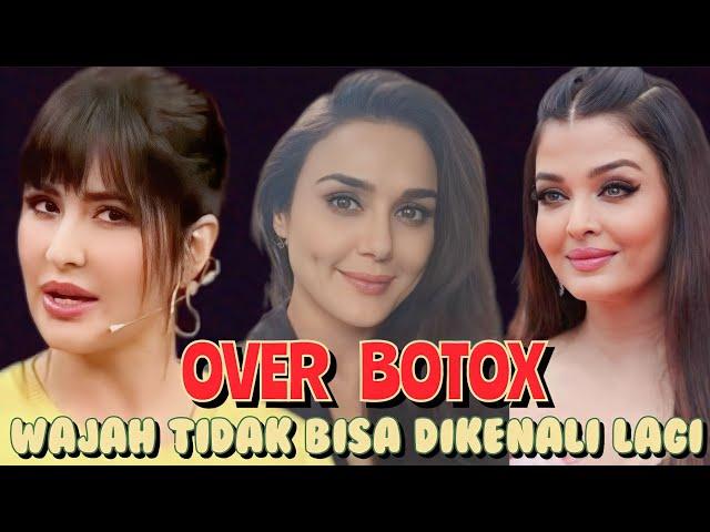 KELEBIHAN BOTOX, WAJAH 7 ARTIS INDIA INI BERUBAH LAIN