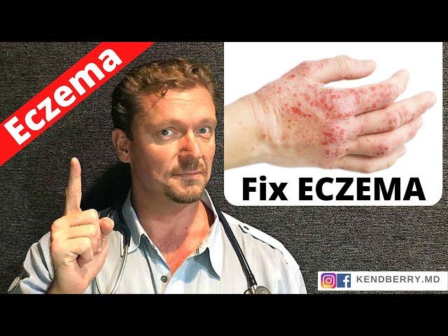 Is this Causing Your ECZEMA? (Easy Way to Tell) 2024