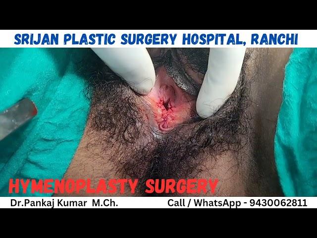 Hymenoplasty Surgery in Ranchi| Virginity restoration surgery| Hymen repair surgery in Ranchi #hymen