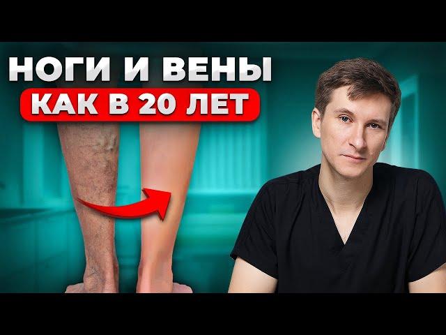 Как вылечить варикоз НАВСЕГДА? Лучшая методика в 2024 году