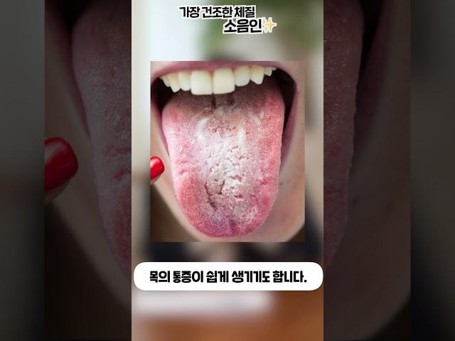 소음인은 가장 건조한 체질
