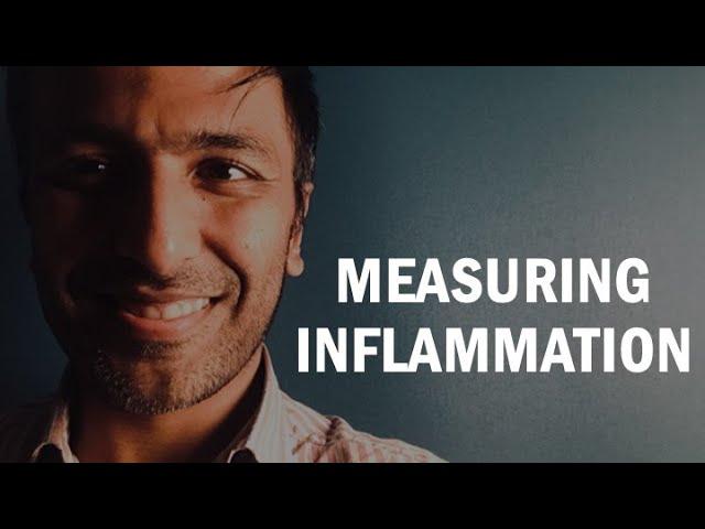 Measuring inflammation - What does CRP tell us?