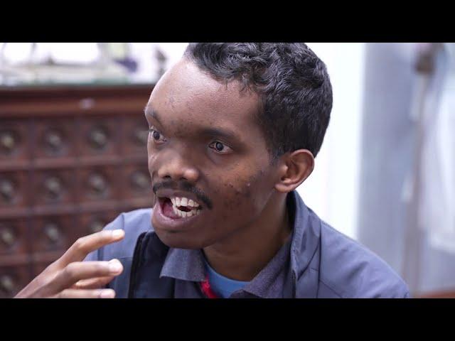 Very Bad Face Deformity for a Man - Pre Surgery