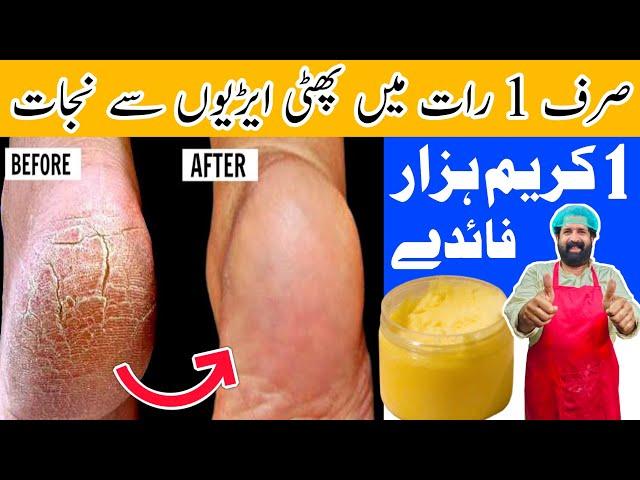 Remove Cracked Heels In Over Night | Get Beautiful Feet Permanently | White & Smooth Feet |BaBa Food