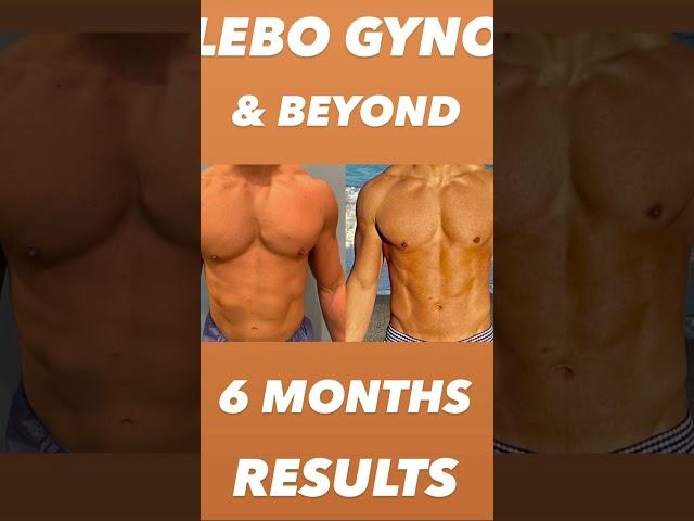 LEBO GYNO & BEYOND: 6 MONTHS POST-OP RESULTS