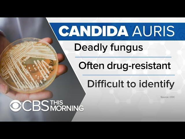 How to protect yourself from the deadly, drug-resistant fungus, Candida auris