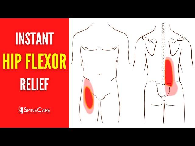 How to Fix Your Hip Flexor Pain | STEP-BY-STEP Guide