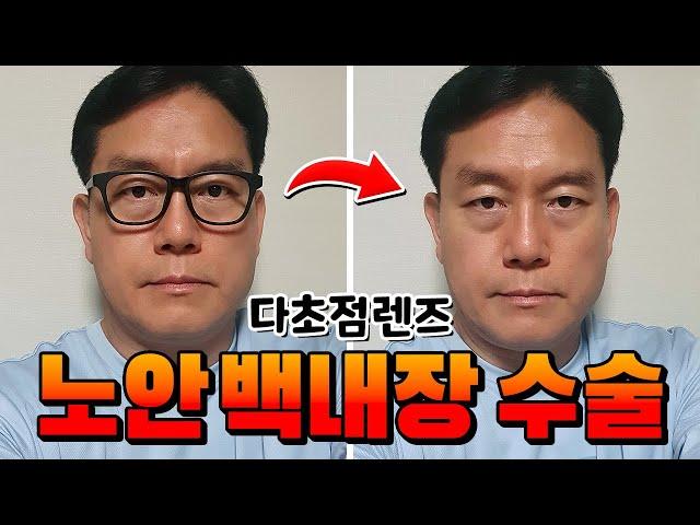 노안백내장 수술(다초점렌즈) 후기 / 시력교정 / 50대 노총각 / 1인 가구 / 유튜브 편집자