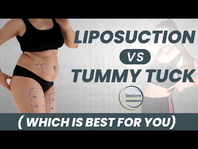 Liposuction vs Tummy Tuck | Benefits of Tummy Tuck Surgery | Restore Aesthetic Mumbai