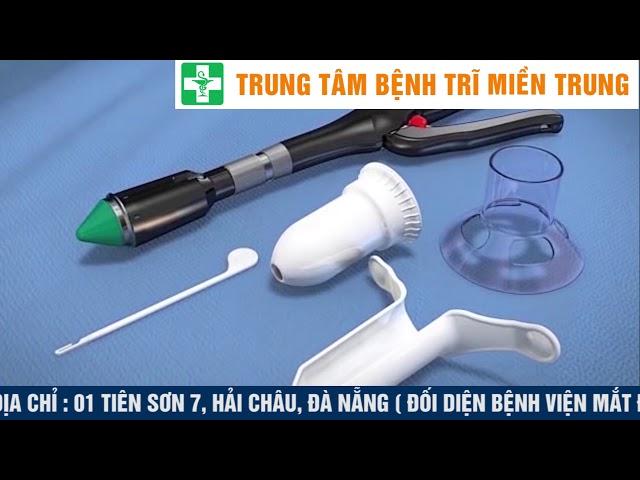 Tổng Hợp Các Phương Pháp Điều Trị Bệnh Trĩ Hiện Nay Trên Thế Giới