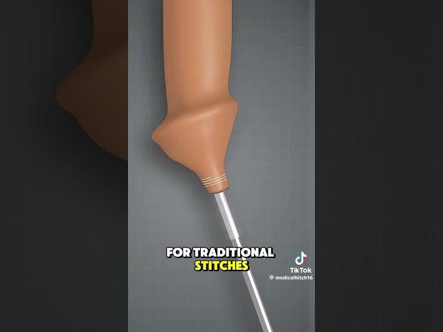 ZSR Circumcision surgery #circumcision #surgery #3danimation ￼