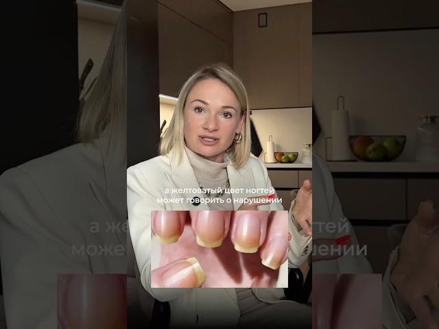 Диагноз по ногтям рук: 5 ОПАСНЫХ ПРИЗНАКОВ #здоровье #диагностика #проблемысногтями