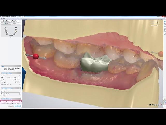 3DBioCAD - 3Shape Dental System Digital Model Design