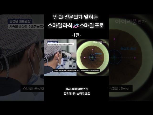 스마일라식 vs 스마일프로 비교 총정리 1탄 - #아이리움안과 #로우에너지스마일프로