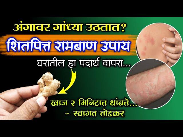 अंगावर गांध्या उठणे थांबेल,खाज 2 मिनिटात बंद; घरातील अद्रक असे वापरा। शितपित्त घरगुती उपाय