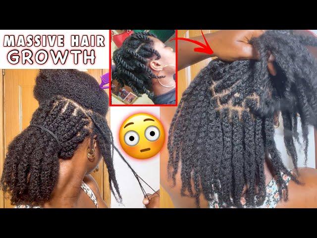 SHOCKING! You Will Never Have Short Hair Again. Mini Braids For 3X Hair Growth & Volume