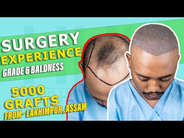 Best Hair Transplant in Guwahati | Best Hair Transplant Result & Cost in Guwahati