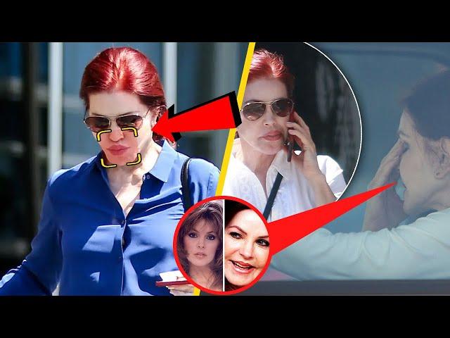 What Really Happened To Priscilla Presley's Face?! 