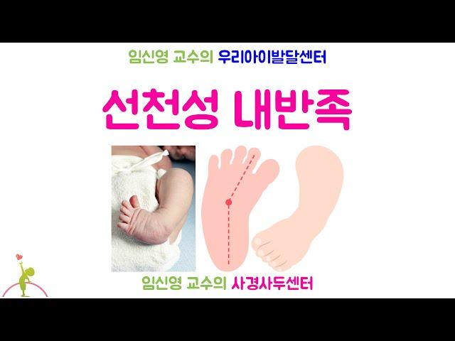 285. 선천성 내반족 Congenital clubfoot