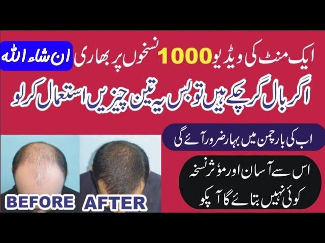 Ganjapan ka ilaj | hairfall treatment in urdu by farooqi dawakhana | گنجے پن کا علاج | #home_remedy