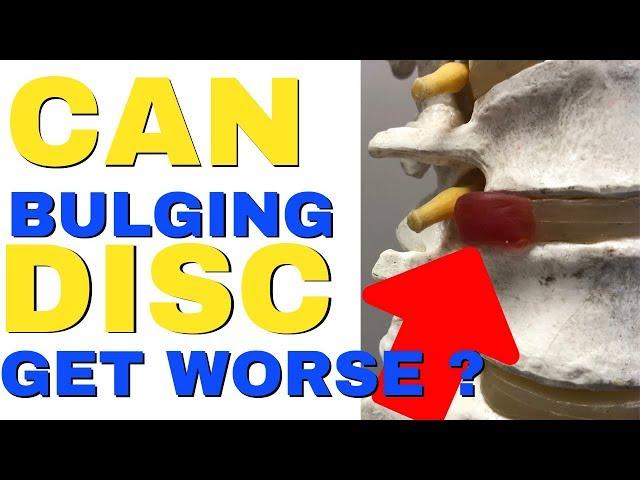 Can A Disc Bulge Get Worse? Can Herniated Disc Get Worse? How Bad Can A Herniated Disc Get?