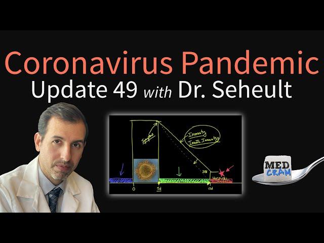 Coronavirus Pandemic Update 49: New Data on COVID-19 vs Other Viral Infections (Ventilator Outcomes)