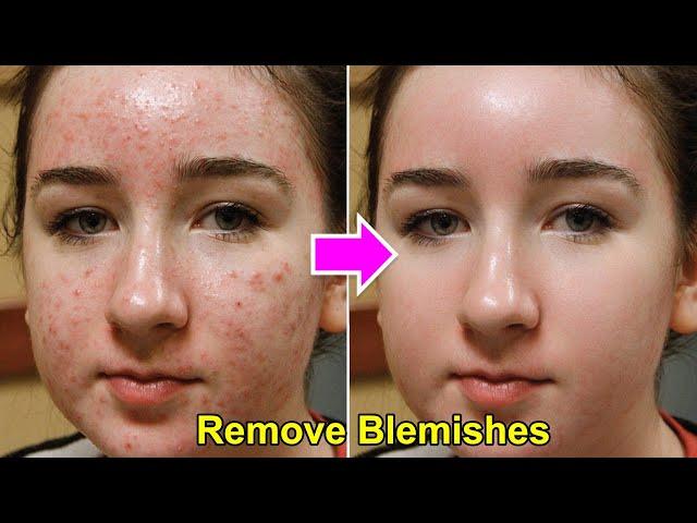 Remove Blemishes and Smooth Skin | Sadesign Panel