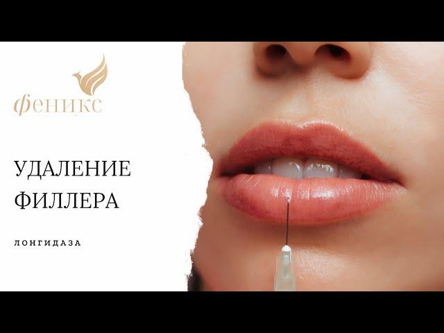 Удаление филлера при помощи лонгидазы