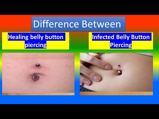 Distinction between Healing belly button piercing  and Infected Belly Button Piercing