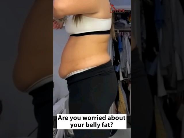 Belly Fat Surgery Result | Abdominal Liposuction Before and After #youtubeshorts