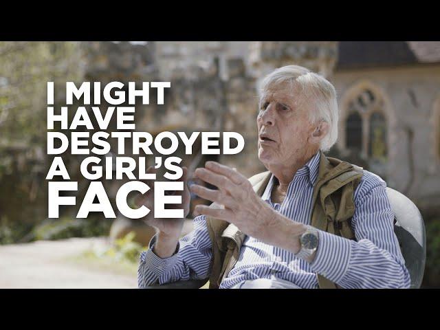 I might have destroyed a girl's face; Prof John Mew