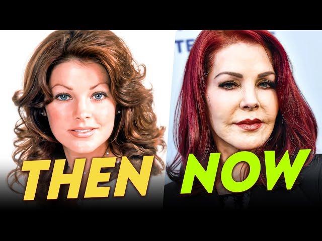 Priscilla Presley | Before & After | Plastic Surgery Transformation