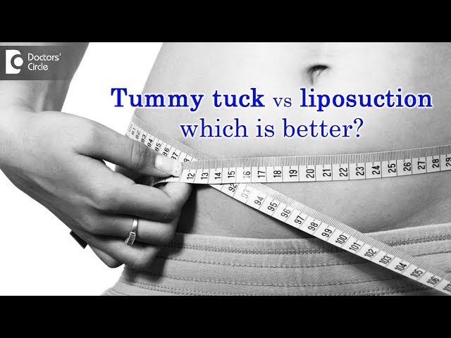 Tummy tuck vs liposuction which is better?