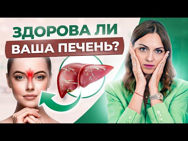 Ваше лицо и язык говорят о больной ПЕЧЕНИ: 5 неочевидных признаков