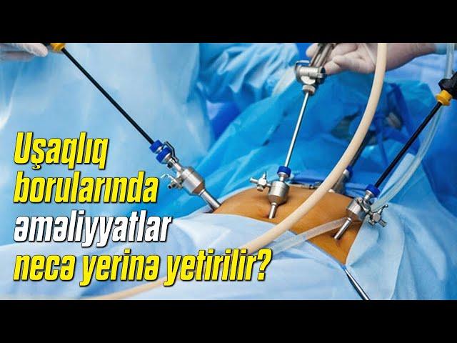 Uşaqlıq borularında əməliyyatlar necə yerinə yetirilir? ( Cərrah mama ginekoloq Aytən Nəcəfəliyeva )