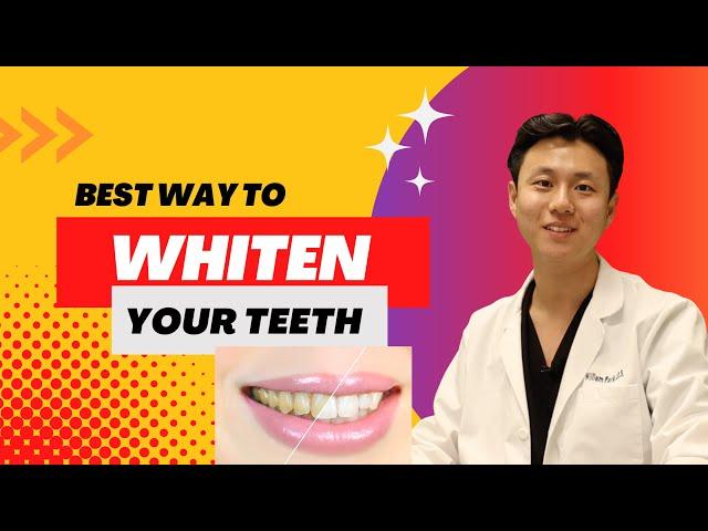 Best Teeth Whitening Method? | DENTIST ANSWERS
