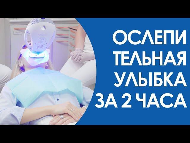 Отбеливание зубов - современная система ZOOM 4 и другие способы mp4