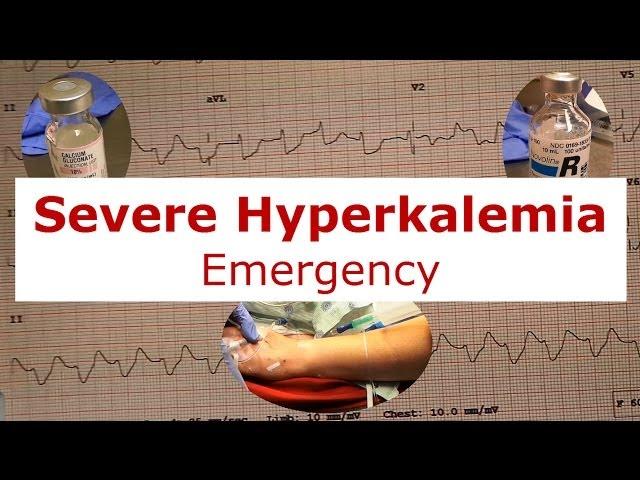Severe Hyperkalemia Emergency