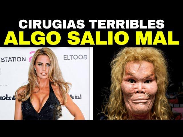 20 FAMOSOS Antes y Después De Una Cirugía Plástica