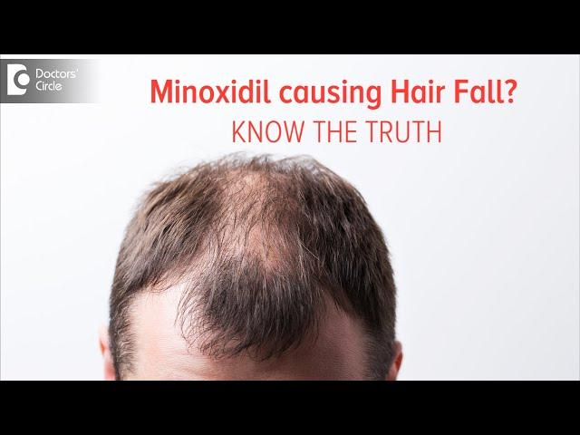 KNOW THE TRUTH | Does Minoxidil Solution cause Hair Fall?- Dr. Deepak P Devakar | Doctors' Circle