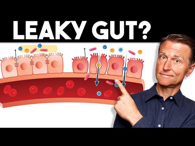 7 Signs of a Leaky Gut — Dr. Berg