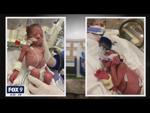 Newborn-mother bonding technique helps NICU baby grow | FOX 9 KMSP