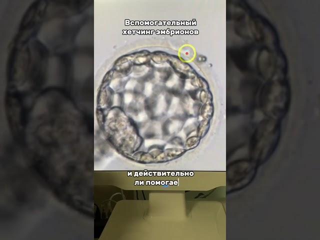 Вспомогательный хетчинг эмбрионов — что это такое, зачем проводится и действительно ли помогает? ⤵️