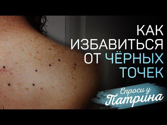 Гигантские "черные точки" как удалить?