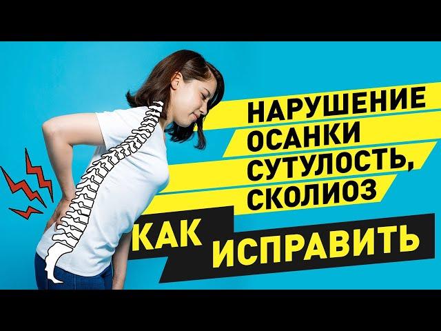 Нарушение осанки, сколиоз как исправить.