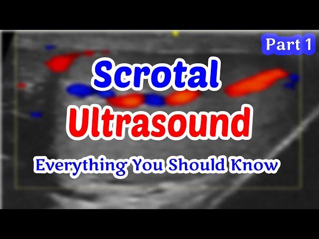 Scrotal Ultrasound Everything You Should Know (part 1)