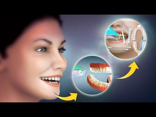 AMAZING Teeth Whitening Procedure | Cosmetic Dentistry