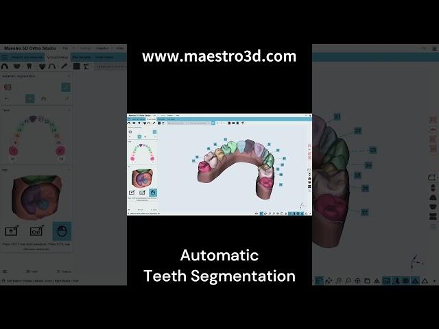 Maestro 3D | Dental Studio