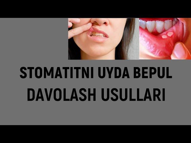 Stomatitni uyda to'g'ri davolash usullari