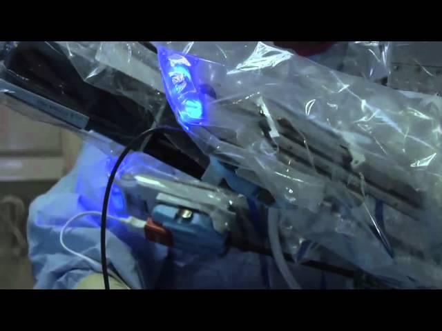 Video about how an Iowa hospital is preventing surgical site infections